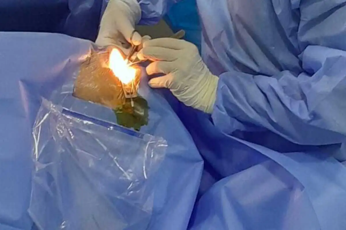 Jasmin Cerić Klinika International PLUS- zahvat na Jasminovom oku trajao je 20 minuta