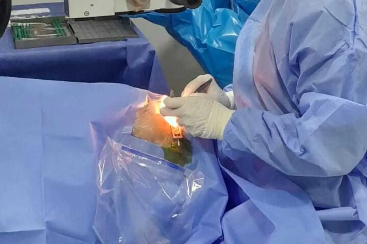 Jasmin Cerić Klinika International PLUS- zahvat na Jasminovom oku trajao je 20 minuta